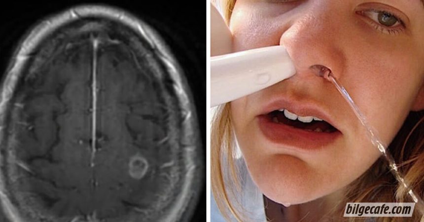 69 Yaşındaki Kadın Burnunu Yıkamak İçin Musluk Suyu Kullandı Sonrası Herkese İbret Oldu... 1 musluk suyu