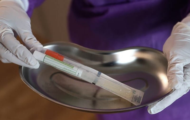 Evinizde Varsa Hemen Atın Dünya Sağlık Örgütü Paylaştı 5 dso4