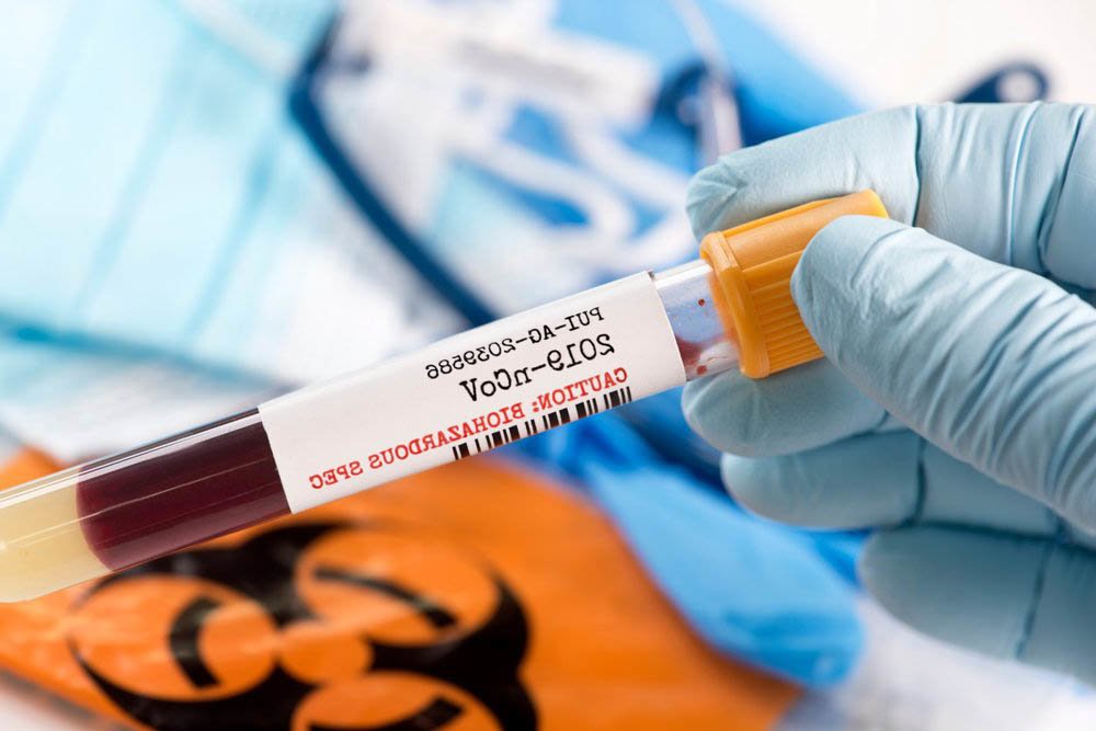 Eldiven Takmak Doğru Mu? Yanlış Mı? 2 eld