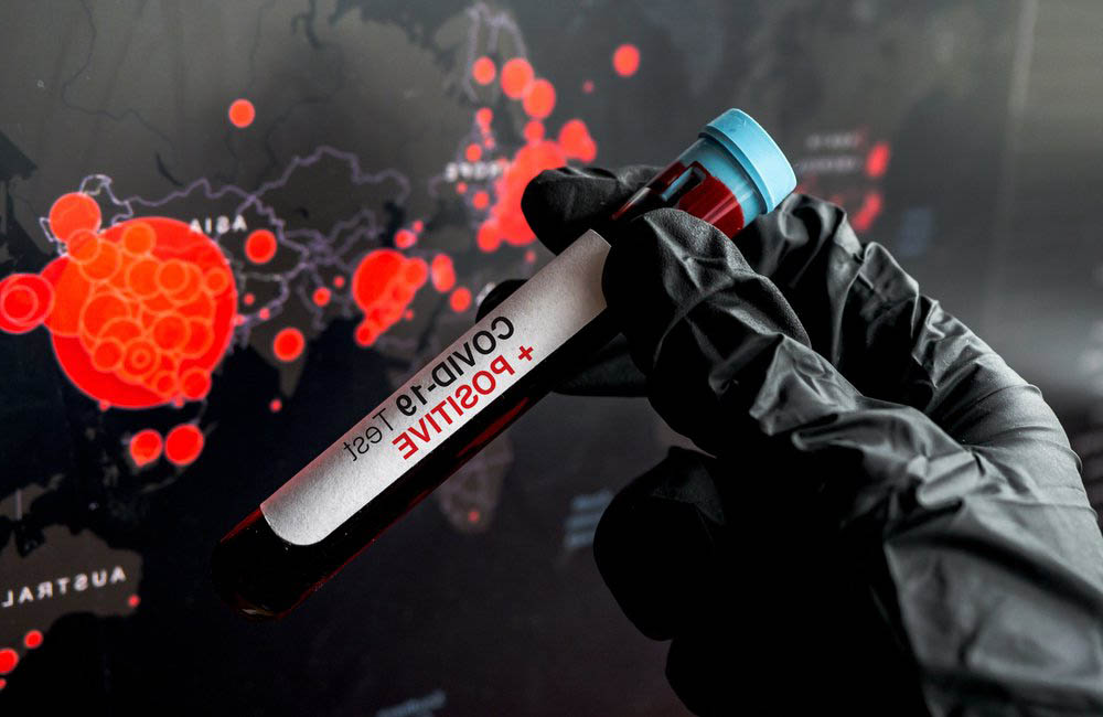 Eldiven Takmak Doğru Mu? Yanlış Mı? 6 eldiven3