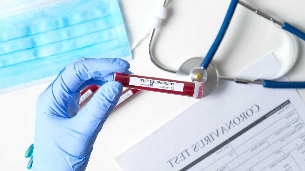 Eldiven Takmak Doğru Mu? Yanlış Mı? 4 koro