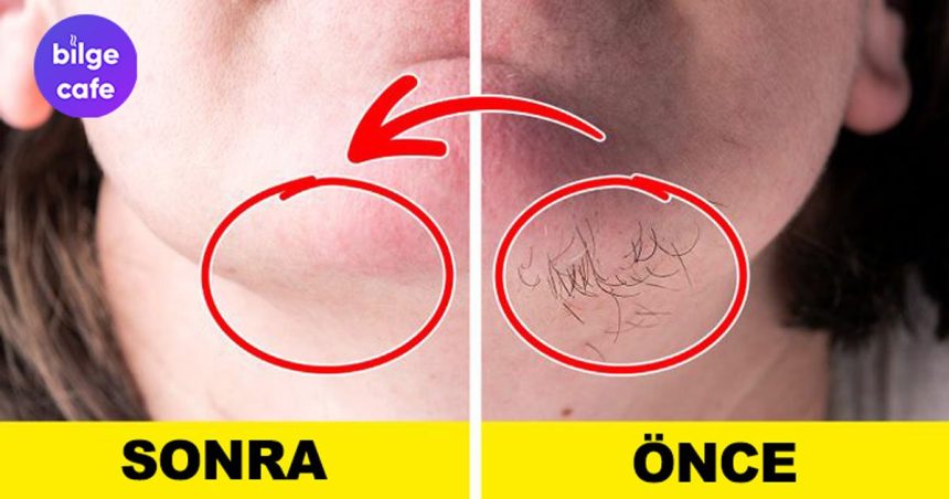 evinizdeki malzemelerle yuzunuzdeki tuylerden kurtulun