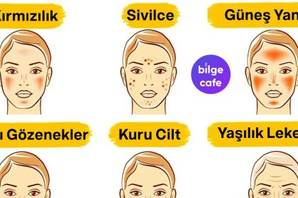 Yüzünüzdeki Cilt Sorunlarını Yok Edecek, Kolay Uygulanabilir 6 Doğal Yöntem 24 yuzunuzdeki cilt sorunlarini yok edecek kolay uygulanabilir 6 dogal yontem