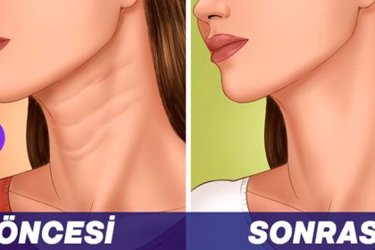 Boyun Çizgilerinizi Yok Edecek ve Sizi Genç Gösterecek Yöntemler 18 boyun cizgilerinizi yok edecek ve sizi genc gosterecek yontemler