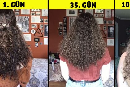 100 gun yikanmayan saclar