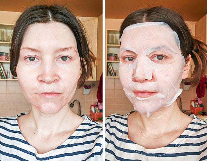 1 Ay Boyunca Yüz Maskesi Kullandım Ve Deneyimlerim 4 14.gun