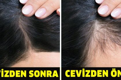 Her Gün Ceviz Yerseniz Ne Olur ? 12 cevizden once ve sonra