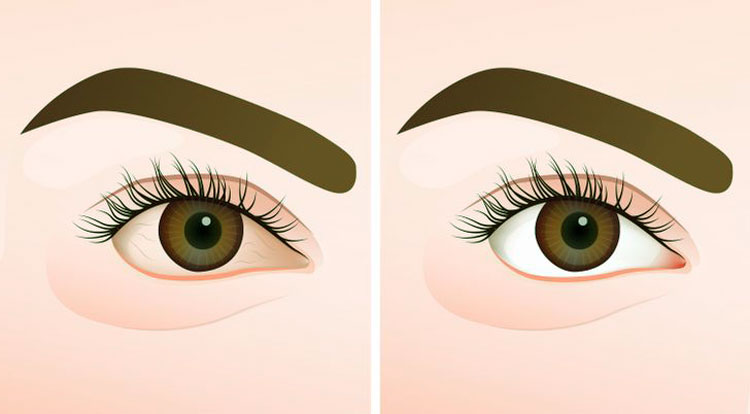 Yerde Uyumaya Başlarsanız Ne Olur? 7 alerji