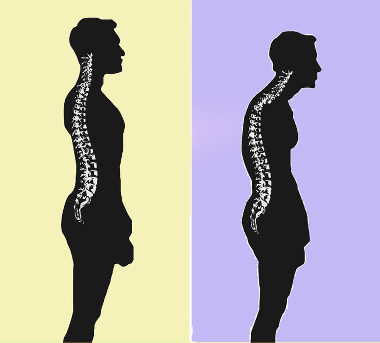Yerde Uyumaya Başlarsanız Ne Olur? 3 kamburluk