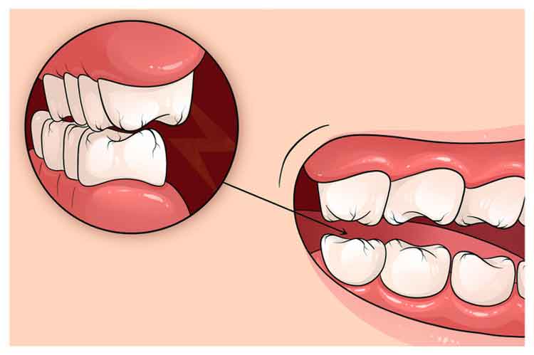 Sürekli Stres Altında Olduğunuzun 6 İşareti 2 stres dis