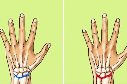 uzun sure kol saati takilirsa ne olur